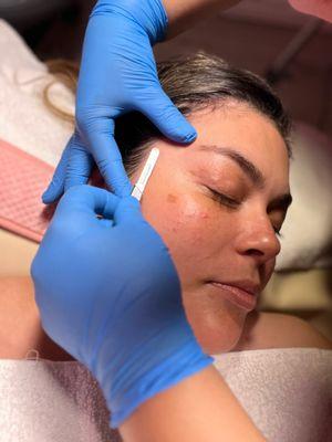 Dermaplaning - taking off all the fuzz!