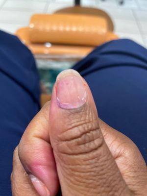 My nail turned purple from acetone sitting on for an hour. The previous color I had was orange/red.