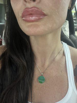 After my 2nd session