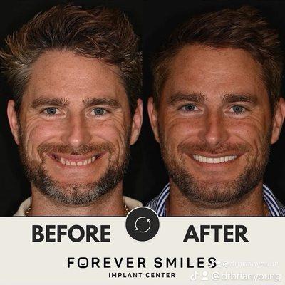 Forever Smiles Implant Center