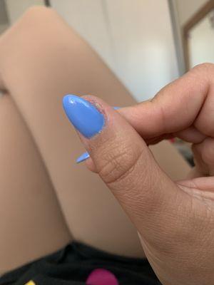 My thumb has some odd skin and it hurts I am not sure what happened here maybe he didn't cover whole nail.