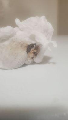 This is dried bird poo on top of fridge sorry I immediately start cleaning.