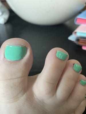 she filed short enough to draw blood and kept cutting the edges and skin with the cuticle tool