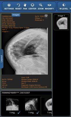 He not only didn't think enough of telling me, he discharged me as his patient for no reason given