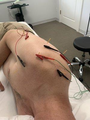 Naples Premier Physical Therapy
