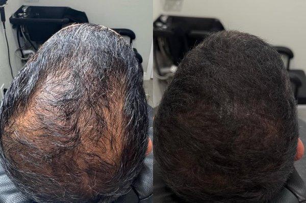 Tip Pivot Lux Beauty Brand