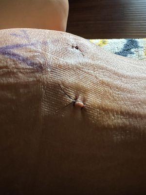 Mission Valley Heights Surgery Center