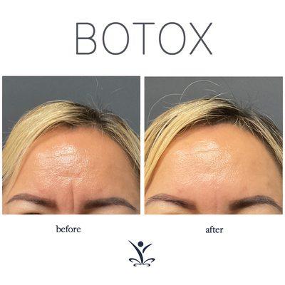 RejuvenationMD