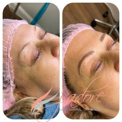 Microblading