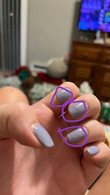 Almost filed to my raw skin.