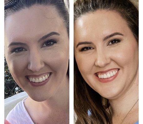 Nicole M Armour, DMD