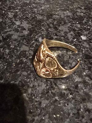 Cut off front a injury