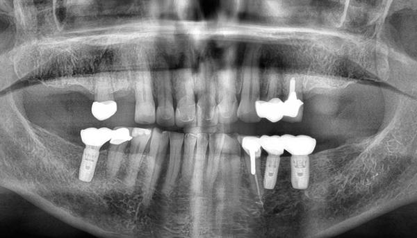 Greenhills Dental Care