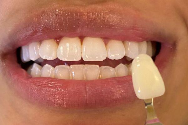 30 minutes could get you shades whiter!
Why not try it, its only 30 mins?!