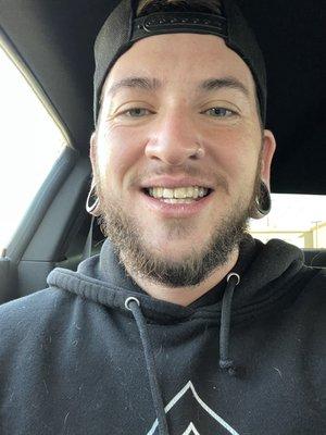 My brand new smile!