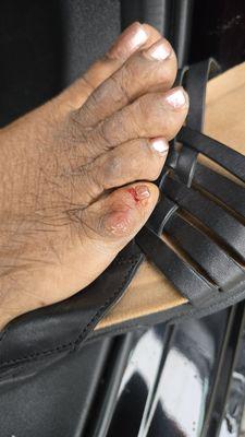 This happened today during a pedicure there.