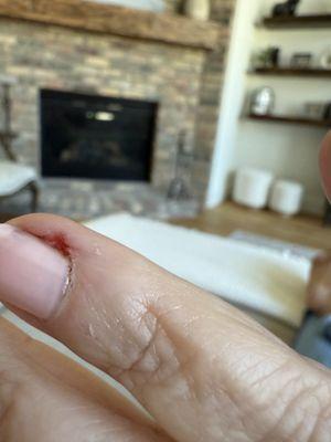 This what my nail looked like...