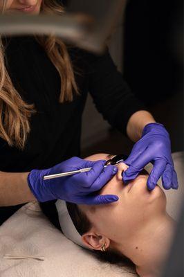 Pure Skin Acne Clinic