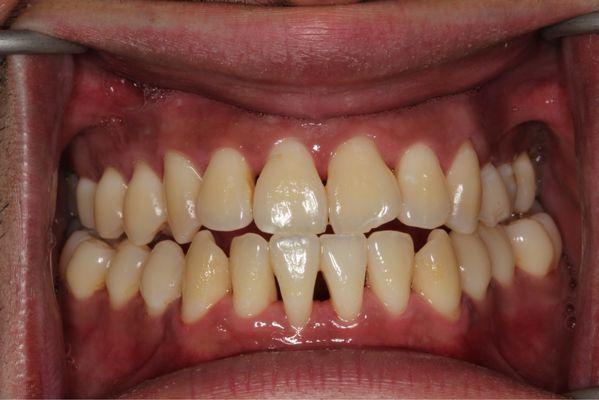 Coffee every morning.