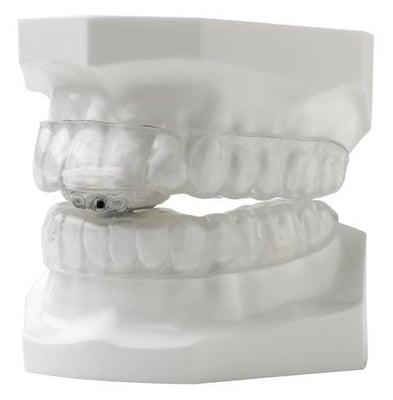 Example Of Oral Appliances We Use For Obstructive Sleep Apnea