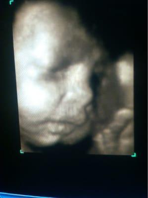 Beautiful quality ultrasound