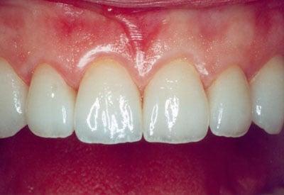 Appleton Aesthetic Dentistry