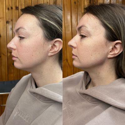 KISS Medical Aesthetics