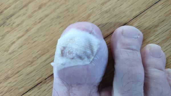 Foot & Ankle Specialists of the Mid-Atlantic - Mt Airy, MD