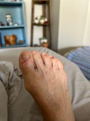 During the pedicure, my mom got completely cut up and they were fast and without care.