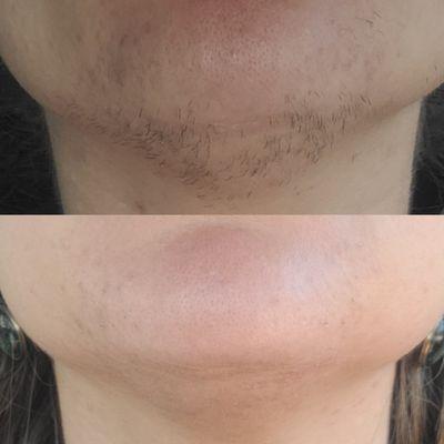 Free To Be Electrology