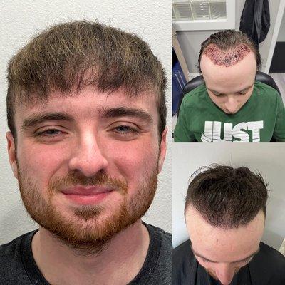 Mane Image Hair Replacement Center