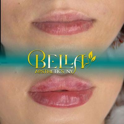 Bella Aesthetics