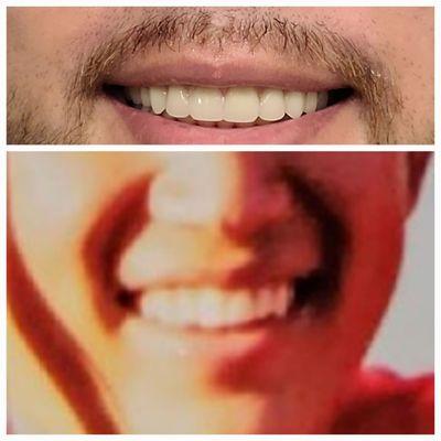 San Diego Prosthodontics