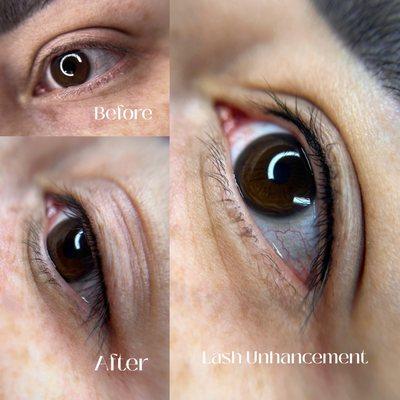 Lash Enhancement