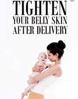 Our state of the art RF laser can tighten skin of different areas of body. Results may vary