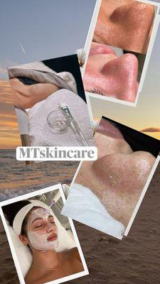 MT Professional Skin and Body Care