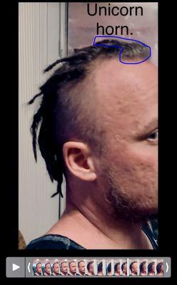 Immediately after second session. This horn was 2.5 times the size of sections in back. Notice all the loose hairs.