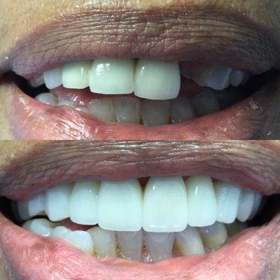 Pasadena Smile Center