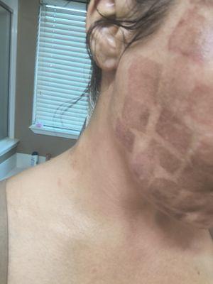 This is all over my face