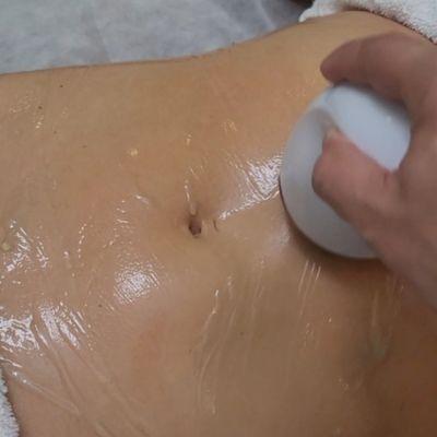 Cavitation treatment for bodyfat