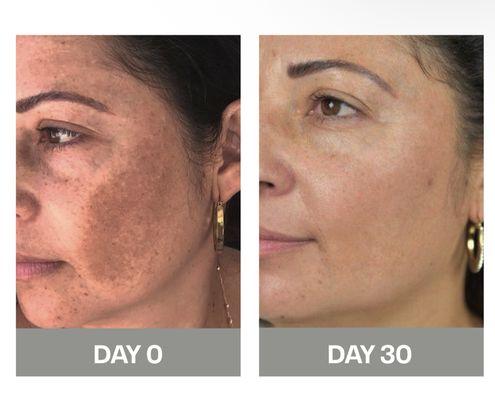 Renu21 Organic Facial & Nail Spa