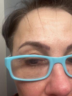 The right eyebrow that extends too far inward.