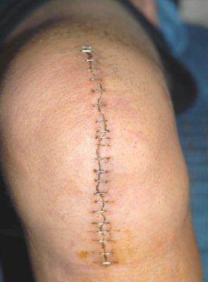 ProCare Physical Therapy