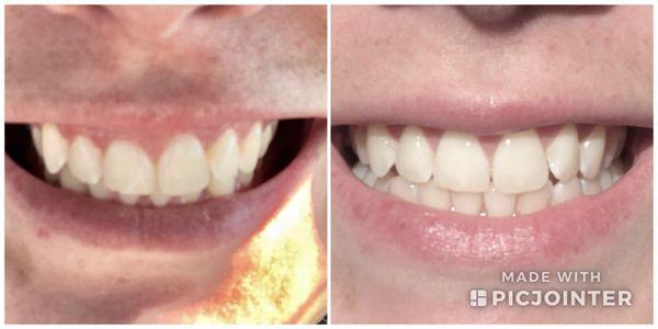 The difference is subtle, but means the world to me