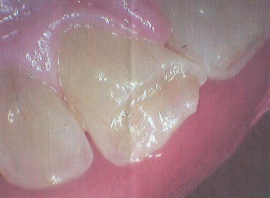 Premier Care Dental-Medford