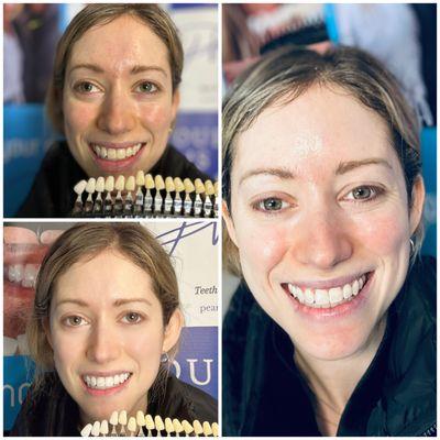 Pearly Whites Teeth Lady