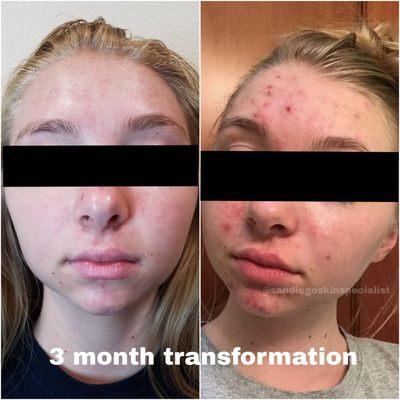 San Diego Skin And Acne Specialist