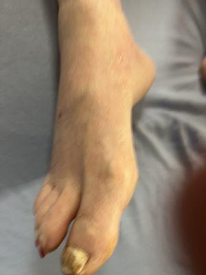 Kimball Farms Lifecare Retirement Community