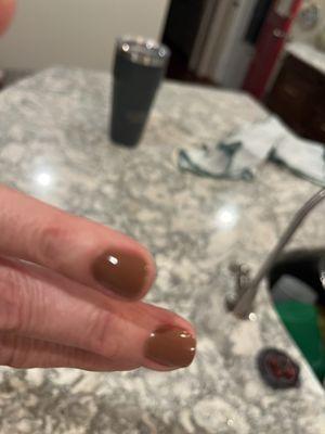 Bad cuticle treatment