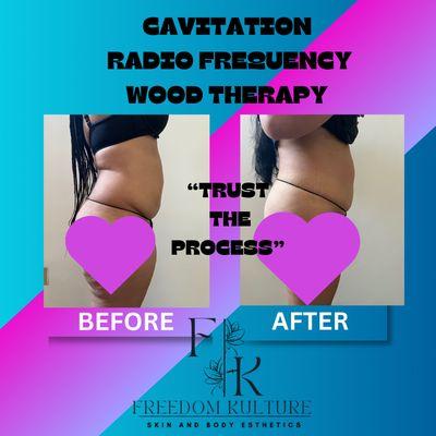 Freedom Kulture Esthetics